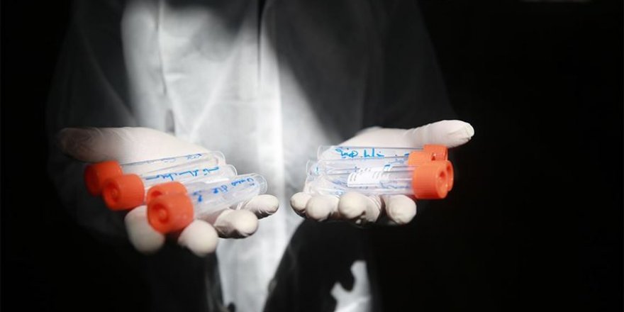 Gazze’de Kovid-19 test kapasitesi yarıya düştü