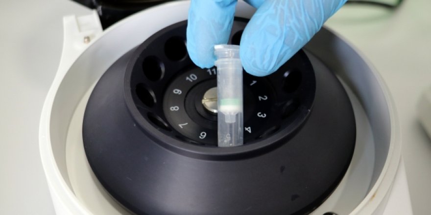 KKTC'de Covid-19 test kiti geliştirildi