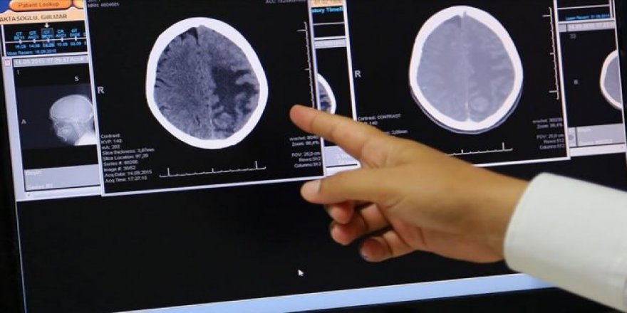 Beyin sağlığımız davranışlarımıza bağlı