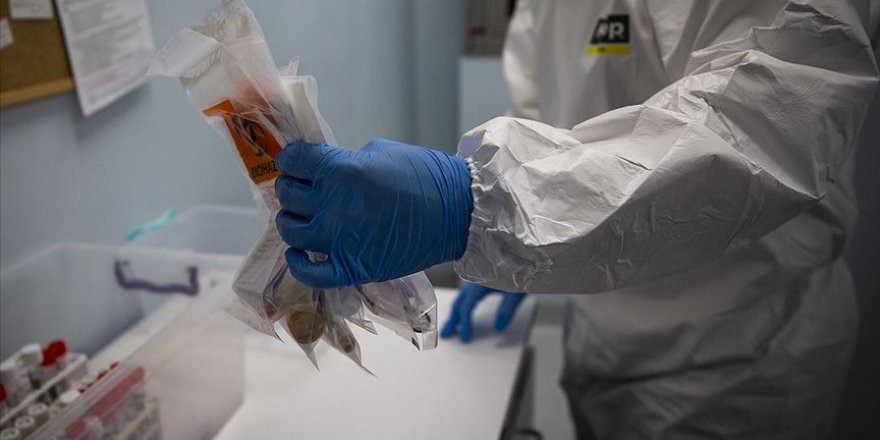 Kovid-19 tanı kitlerinde yeni dönem