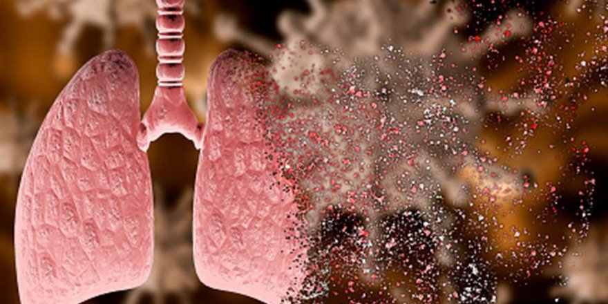Kovid-19 nedeniyle gelişen akciğer yetmezliğinden aylarca süren ECMO tedavisiyle kurtuldu