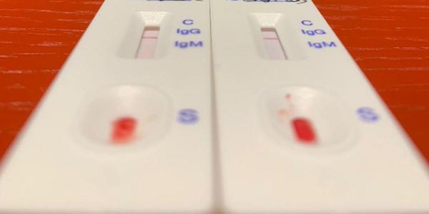 Tıbbi mikrobiyologlardan mutasyona uğramış Kovid-19'a karşı daha sıkı tedbir uyarısı