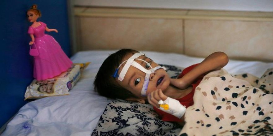 Dünya genelinde 5 yaşın altında 11 milyon çocuk açlıktan ölme sınırında