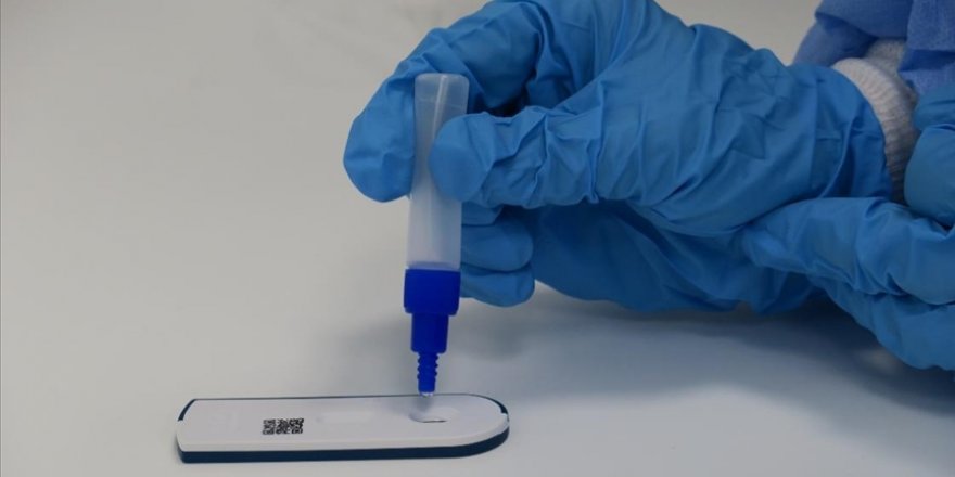 Yerli firma Kovid-19 antijen testi üretti, 20 ülkeye ihraç etti