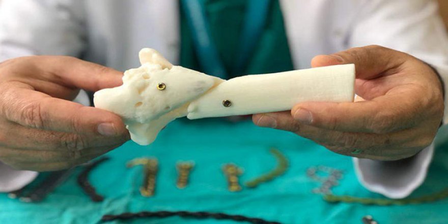 Ameliyattan önce ameliyat provası ile kişiye özel kırık tedavisi