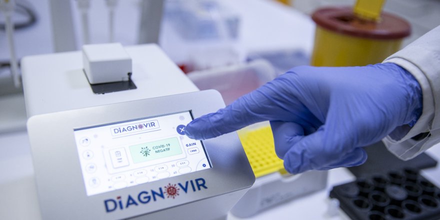 Türk bilim insanları koronavirüs teşhisini 10 saniyeye düşüren tanı sistemi geliştirdi