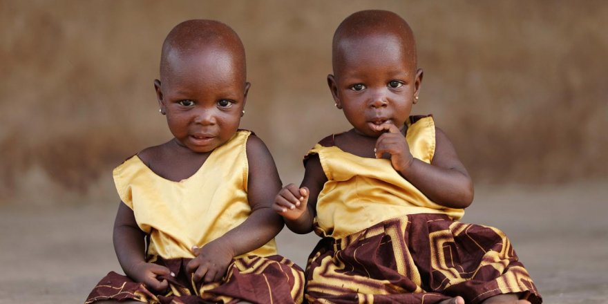 Tek yumurta ikizlerinin o kadar da aynı olmadığı keşfedildi