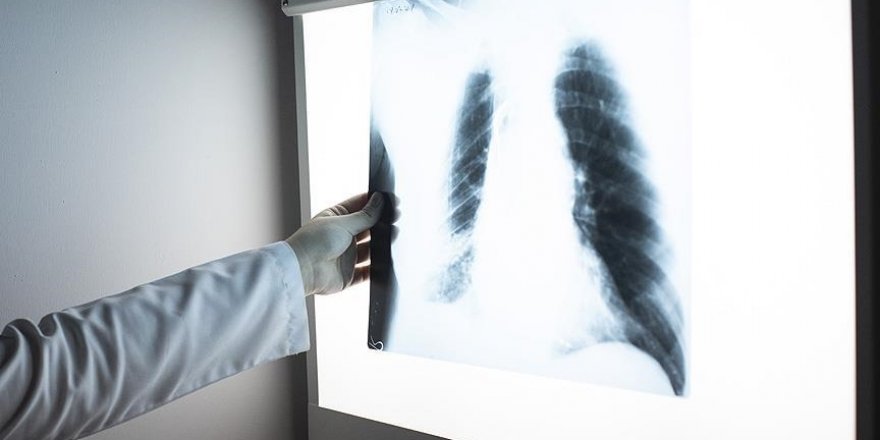 Verem hâlâ en büyük salgın