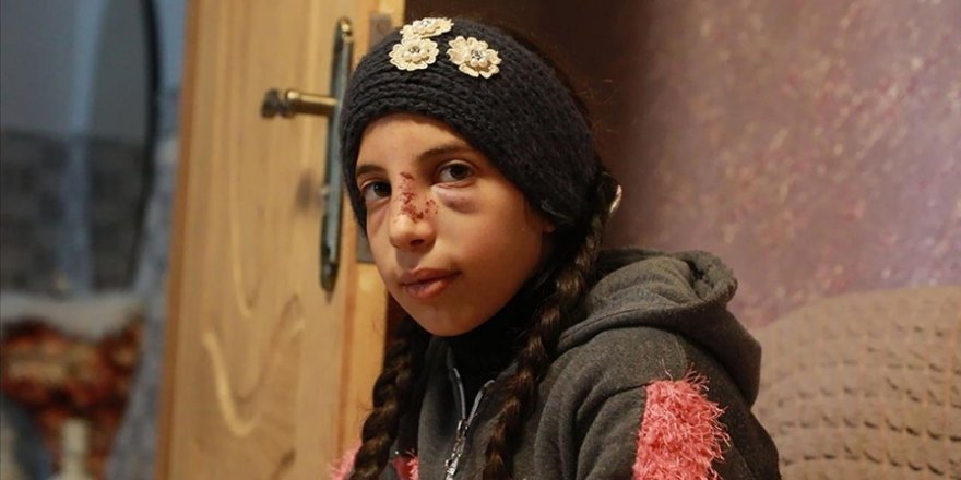 İşgalci Yahudi yerleşimciler 11 yaşındaki Filistinli küçük kıza saldırdı