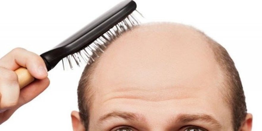 Japonlar kelliğe çare buldu gibi