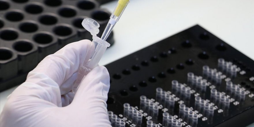 Kovid-19 teşhisini 10 saniyeye düşüren yerli test kullanıma sunuldu