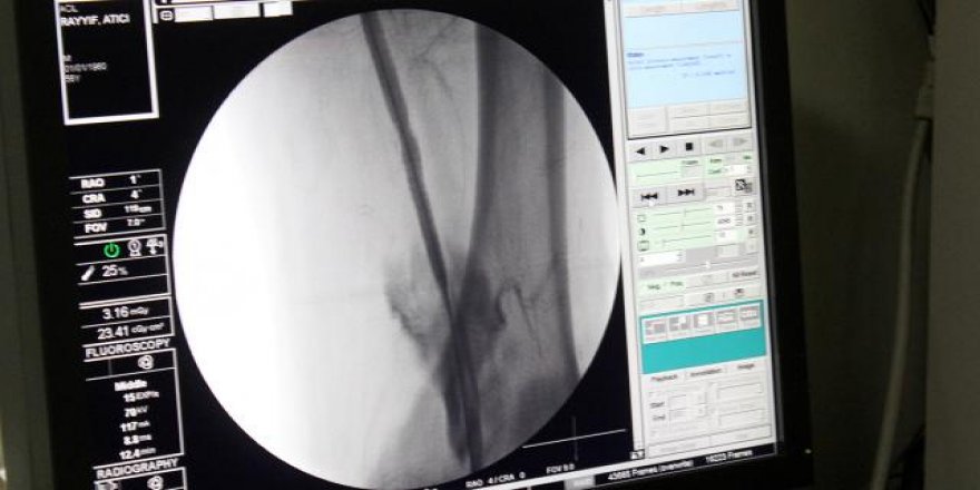 Damar tedavisinde önemli gelişme