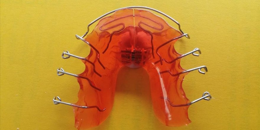 Yapay zeka ortodontik tedavilere de katkı sağlıyor