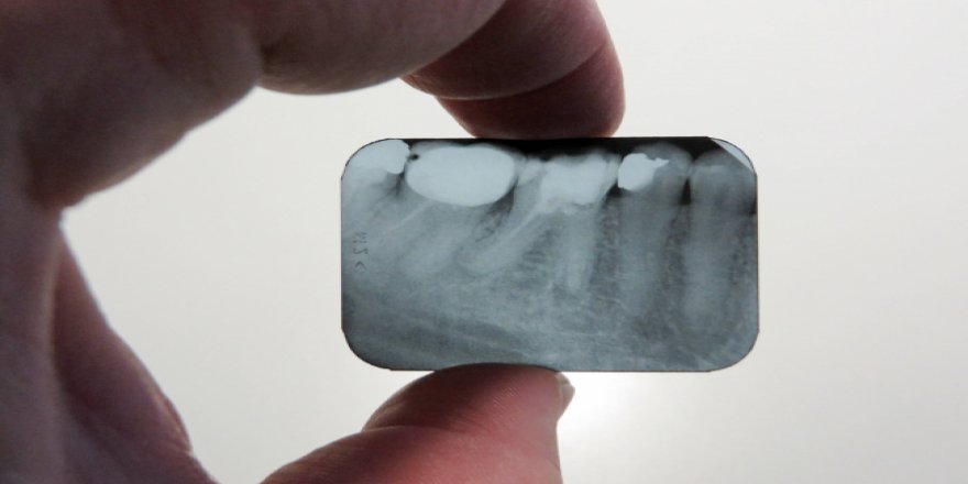 2020'de 100 bin hasta diş tedavisi için Türkiye'ye geldi