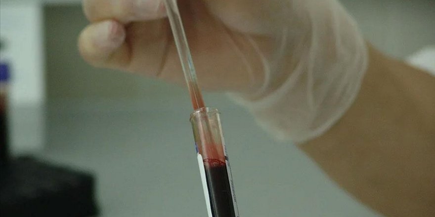 Koronavirüs sürecinde kronik rahatsızlığı bulunanların tedavilerini ertelememesi gerekiyor