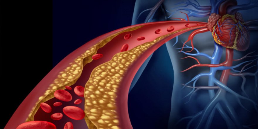Yüksek kolesterollü hastalara yeni umut: Kolesterol aşısı