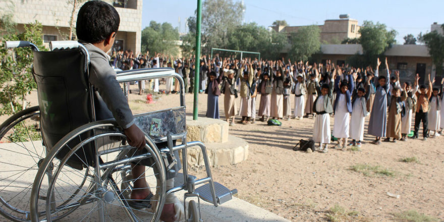 Yemen'deki iç savaşın bedelini halk ödüyor: Binlerce masun sakat kaldı!