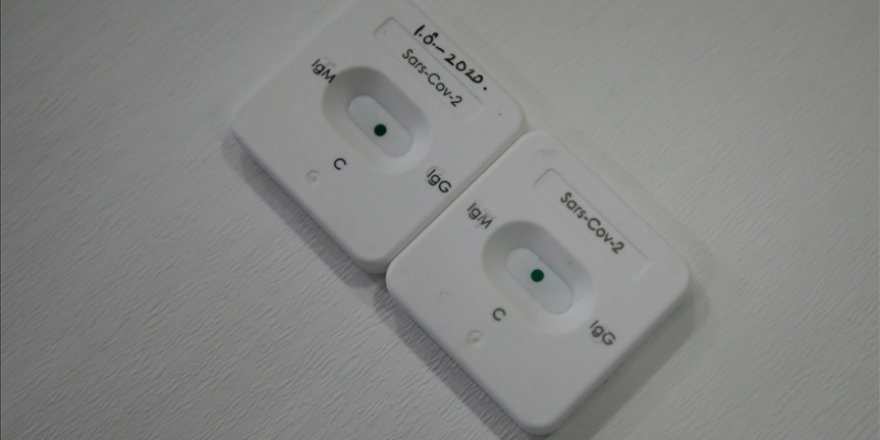 Belçika'da kişilerin kendi kendine uygulayabileceği hızlı Kovid-19 testlerinin satışı başladı