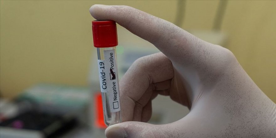 Kovid-19’u hafif atlatan 10 kişiden 1’inde hastalığın etkisi uzun sürüyor