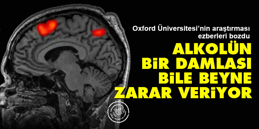 Oxford Üniversitesi: Alkolün bir damlası bile beyne zarar veriyor
