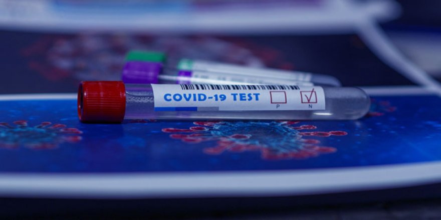 Bilim insanları, hızlı Kovid-19 testinin iç mekanlarda etkinliğini kanıtladı