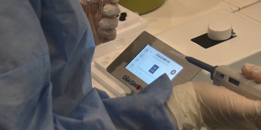 Türk bilim insanları geliştirdi; koronavirüs teşhisini 10 saniyeye düşürüyor