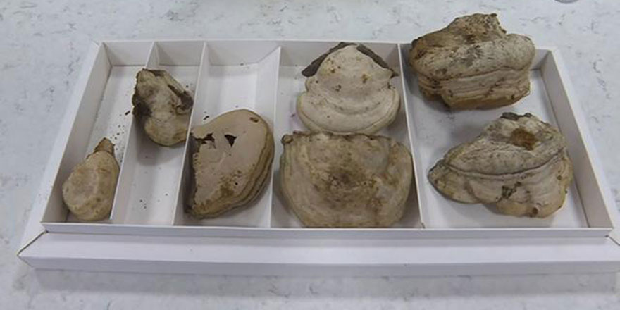 Kav mantarından kanamaları hızla durduran yeni formül bulundu