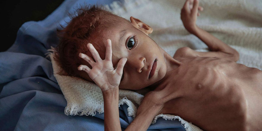 Somali'de kuraklık nedeniyle 3 kişi öldü