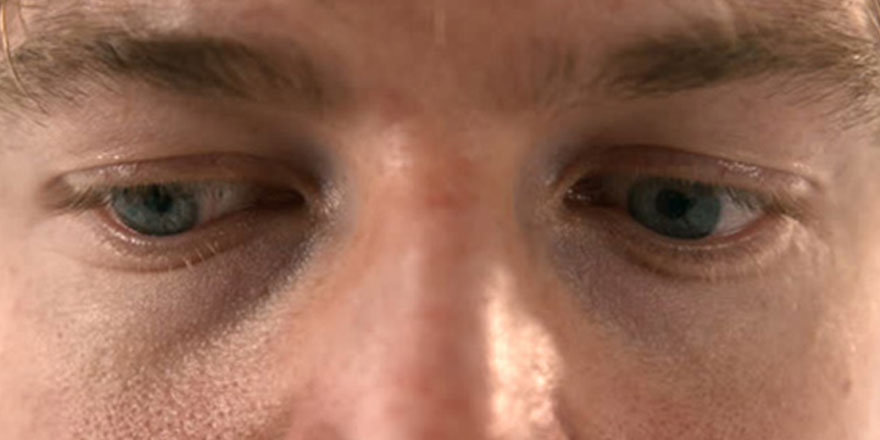 Dünyada bir ilk: Hastaya dijital 3D baskılı protez göz takıldı