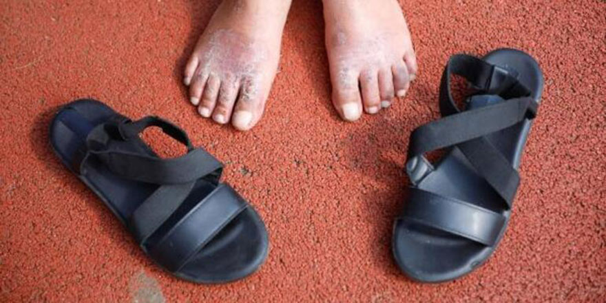 Ucuz ayakkabıyı sadece bir gün giydi ayakları yara oldu