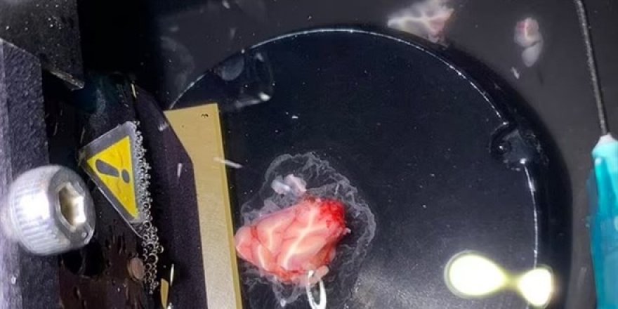 İnsan beyninden alınan bir parça ilk kez dışarıda 12 saat boyunca canlı tutuldu