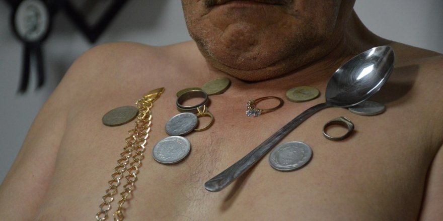 ‘Mıknatıs adam" etrafında ne varsa çekiyor: Tıp bunu açıklasın