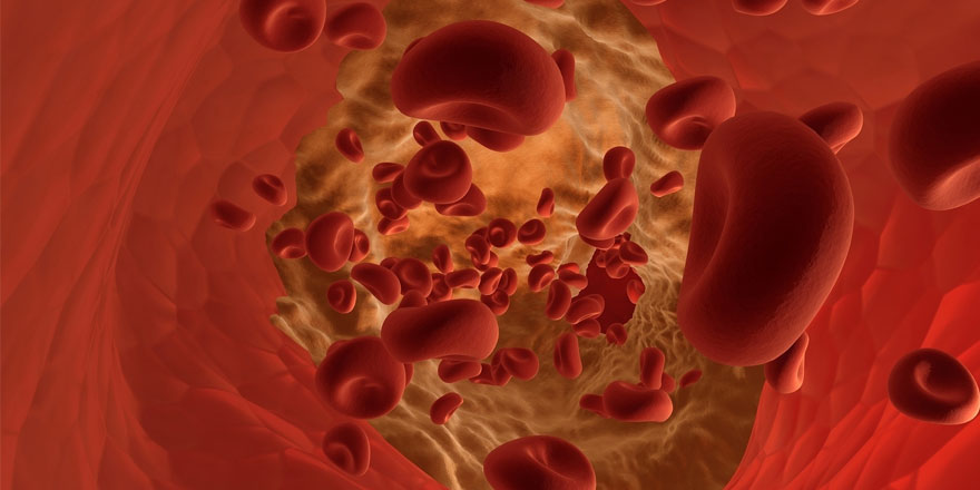 Damardaki pıhtılaşma mikro robot ile açılacak