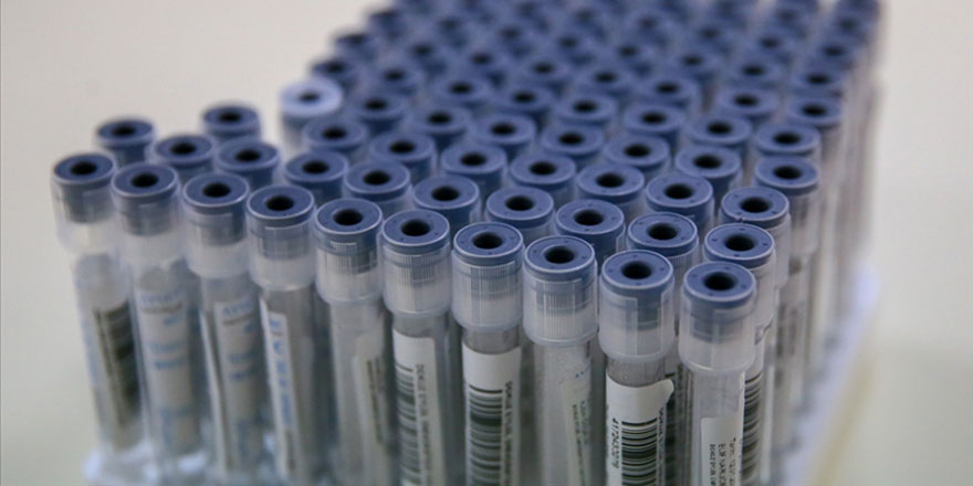 Sağlık Bakanı Koca: Kovid-19 tablosu bugünden itibaren haftalık yayınlanacak