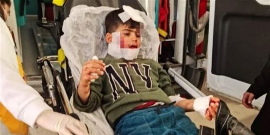 Mardin'de köpeklerin saldırısına uğrayan çocuk ağır yaralandı