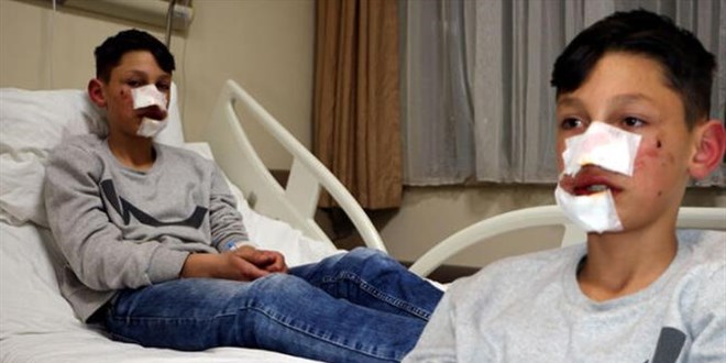 Sokak köpeğinin yaraladığı çocuk ameliyata alınacak