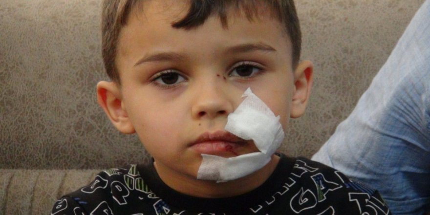 Niğde'de, annesiyle parka giden çocuğa köpek saldırdı