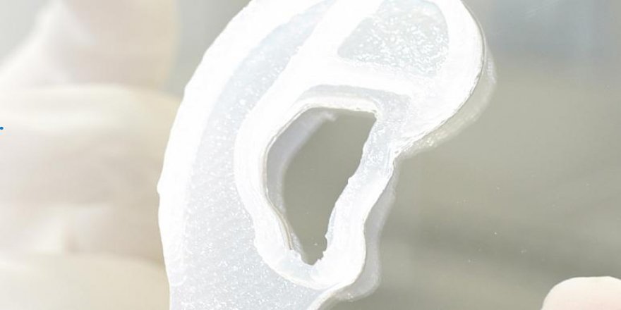 ABD'de bir hastaya canlı hücrelerinden alınarak yapılan 3 boyutlu kulak nakledildi