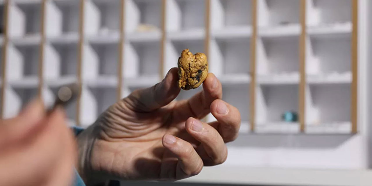 Yutulan cisimler koleksiyonu hastane koridorunda açıldı