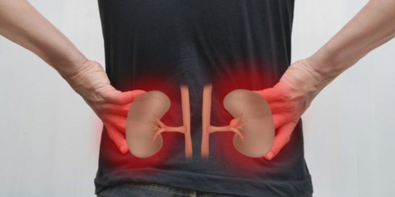 Tekrarlayan böbrek taşlarında metabolik araştırma yapılması önerisi