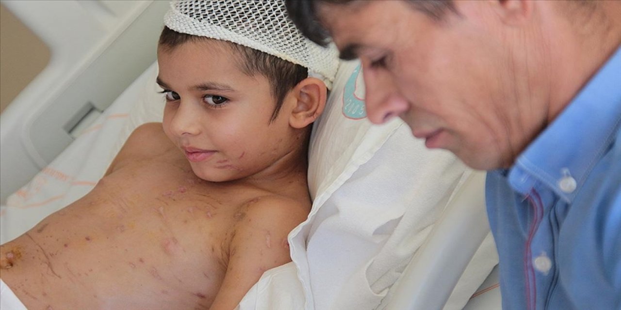Köpeklerin saldırdığı küçük Umut 24 gün sonra taburcu edildi