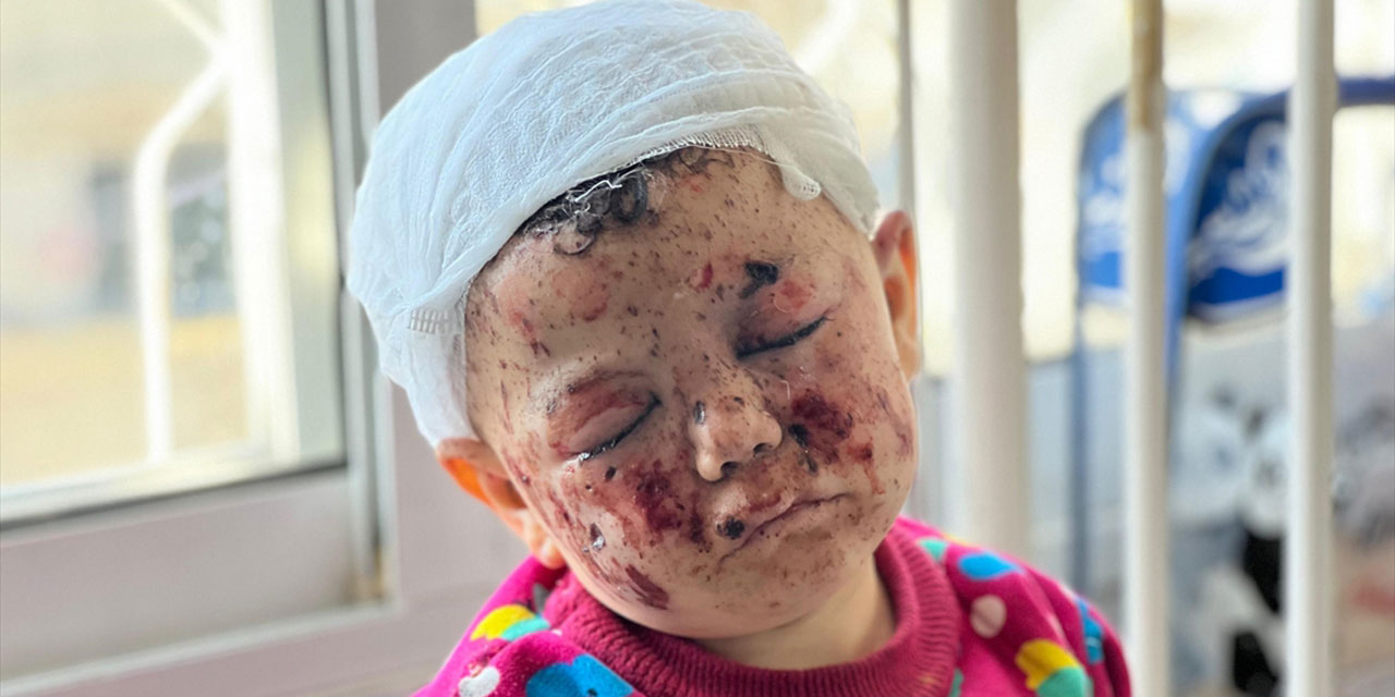 Katil devlet israil, 2 yaşındaki Musab'ın 5 kardeşini öldürdü