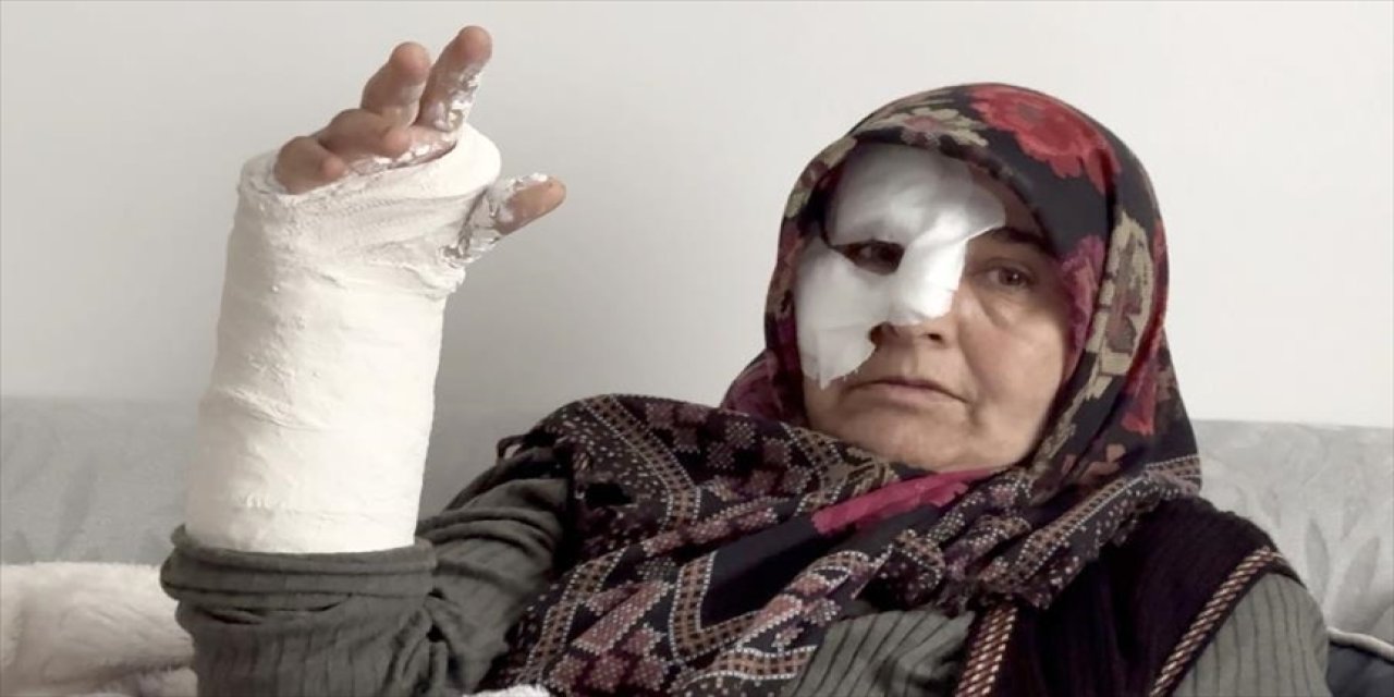 Köpeklerin saldırdığı kadının kolu ve burnu kırıldı
