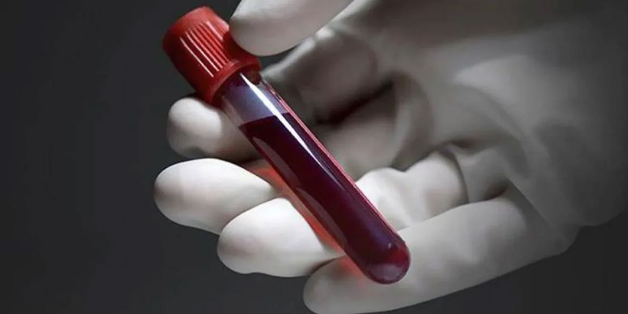 50 yıllık sır çözüldü: MAL adında yeni bir kan grubu keşfedildi