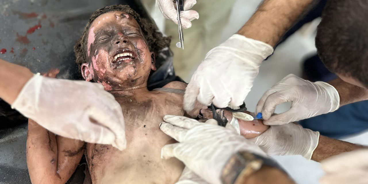 Aşağılık soykırımcı israil Gazze'de çocukları yaktı