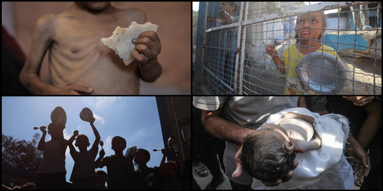 İnsanlığımızdan utanalım: Gazze'de açlıktan ölümler artıyor