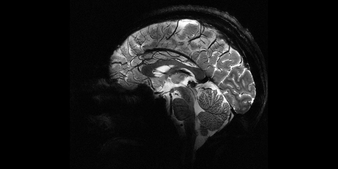 Pandemi döneminde beyinler daha hızla yaşlandı