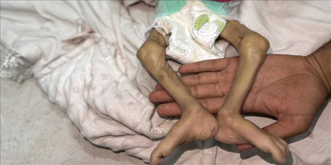 Katil israil: Gazze'de son 24 saatte 1'i çocuk 14 Filistinli açlıktan şehit oldu