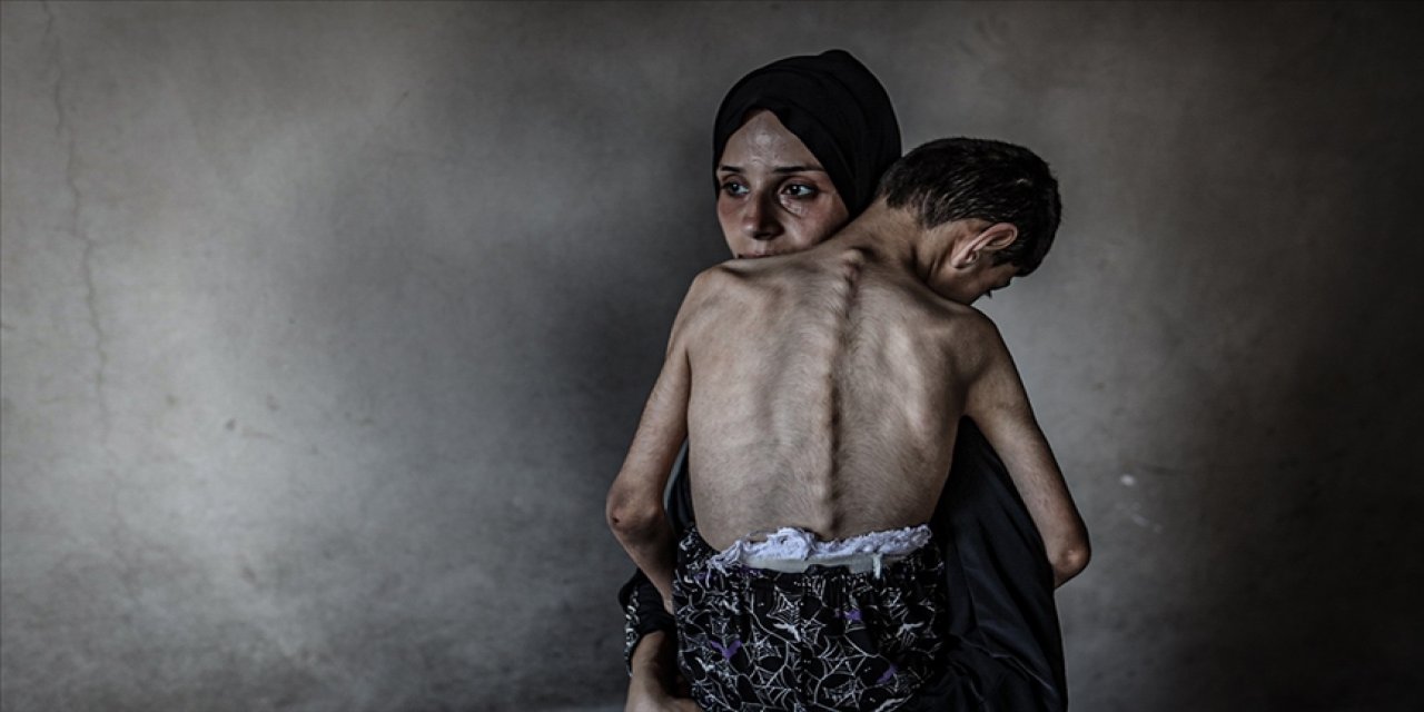 israilin kıtlığı dayattığı Gazze'de son 24 saatte 5 kişi daha açlıktan şehit oldu