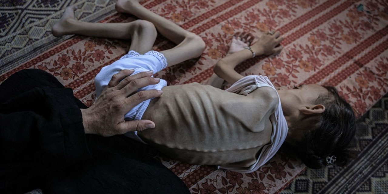 Gazze'de son 24 saatte 3 kişi daha açlıktan şehit oldu